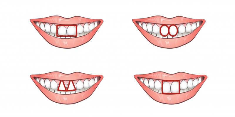 Τι δείχνουν τα δύο μπροστινά δόντια για το χαρακτήρα σας;