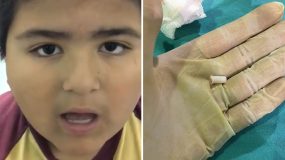 8χρονος κατάπιε εξάρτημα καραμούζας και αντί να μιλάει κορνάρει