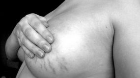 8 αλλαγές που ίσως συμβούν στο στήθος σας κατά την διάρκεια της εγκυμοσύνης