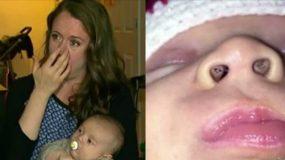 Μια μαμά παρατήρησε μαύρες κηλίδες μέσα στη μύτη του μωρού της... Τώρα προειδοποιεί και τους άλλους γονείς για αυτό που της συνέβη.....