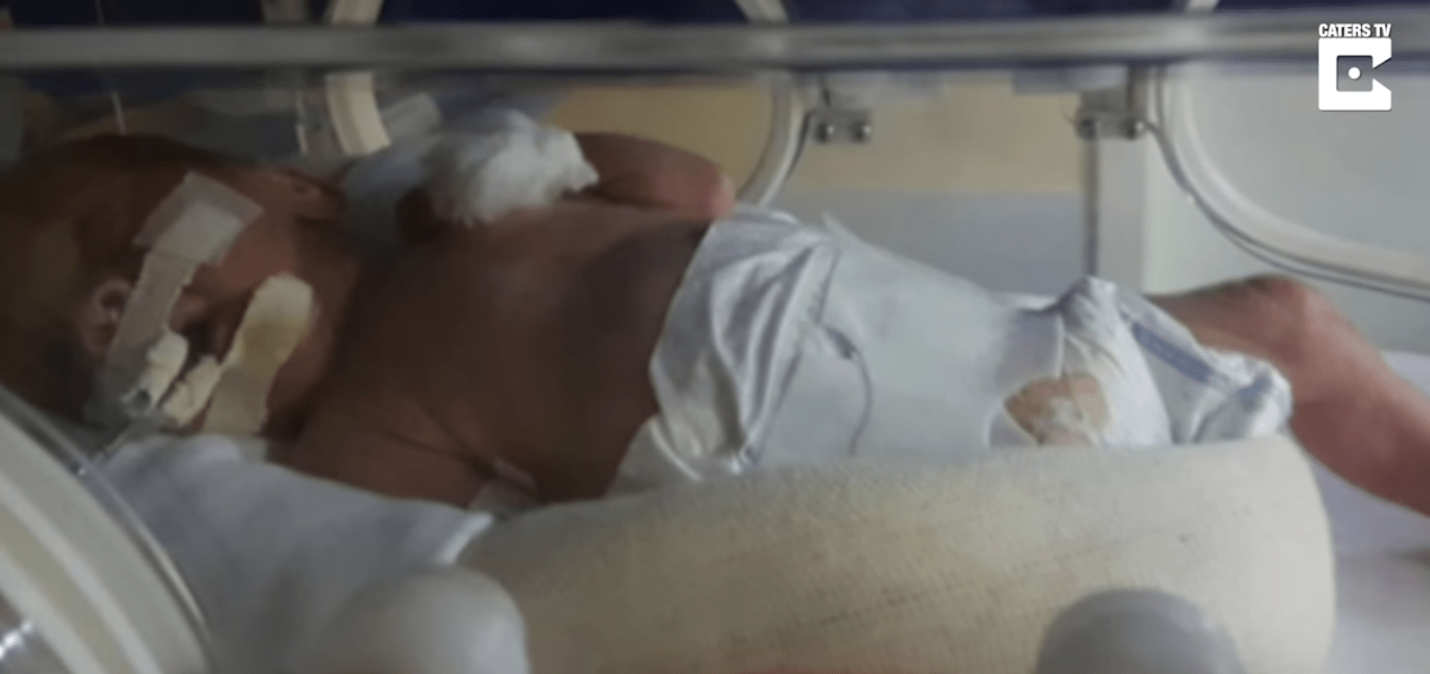 Εγκεφαλικά νεκρή μητέρα κρατήθηκε ζωντανή για 123 μέρες μέχρι που γέννησε δυο υγιέστατα δίδυμα 8 εγκεφαλικη νεκρη γυναικα6