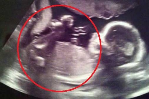 Έγκυος γυναίκα βλέπει στον υπέρηχο έναν «άγγελο» να προσέχει την αγέννητη κόρη της!!!-ΦΩΤΟ