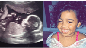 Έγκυος γυναίκα βλέπει στον υπέρηχο έναν «άγγελο» να προσέχει την αγέννητη κόρη της!!!-ΦΩΤΟ