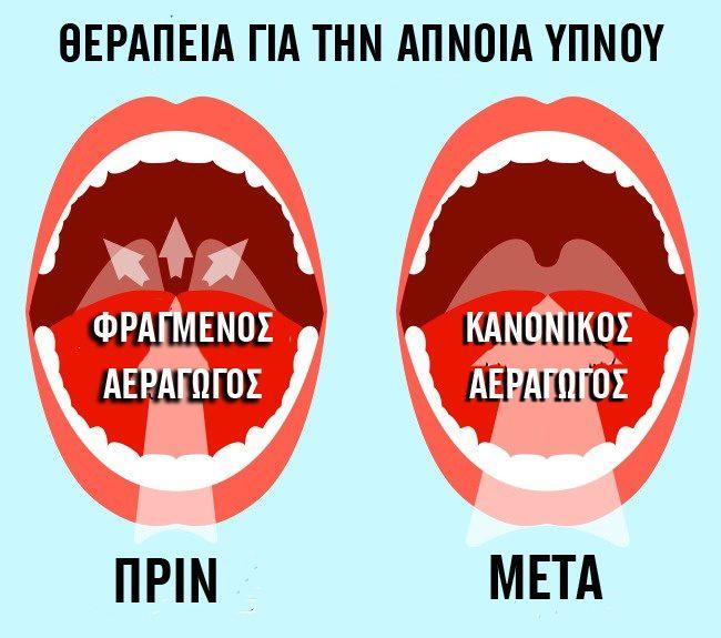 6 τρόποι με τους οποίους το συκώτι σας λέει ότι δεν αντέχει άλλο τον τρόπο ζωής σας 5 συκωτι3
