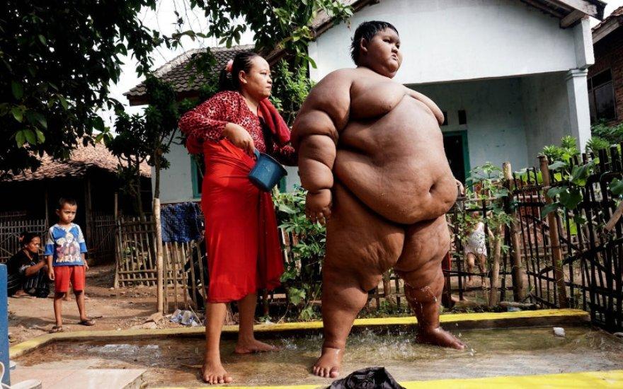 Δείτε πως είναι σήμερα το πιο χοντρό παιδί του κόσμου που κατάφερε και έχασε 76 κιλά (pics-vids)
