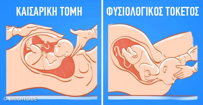 13 διάσημοι μύθοι για την εγκυμοσύνη που είναι αναληθείς και δεν πρέπει να τους πιστεύετε!