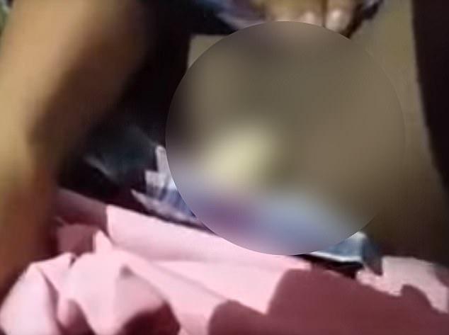 Οι επιστήμονες σηκώνουν τα χέρια ψηλά! 14χρονος από την Ινδονησία ισχυρίζεται ότι γεννάει αυγά από τον πρωκτό του 4 14αχρονος γενναει αυγα3