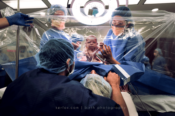 Διαγωνισμός φωτογραφίας παρουσιάζει τις πιο εντυπωσιακές φωτογραφίες εγκυμοσύνης και τοκετού!
