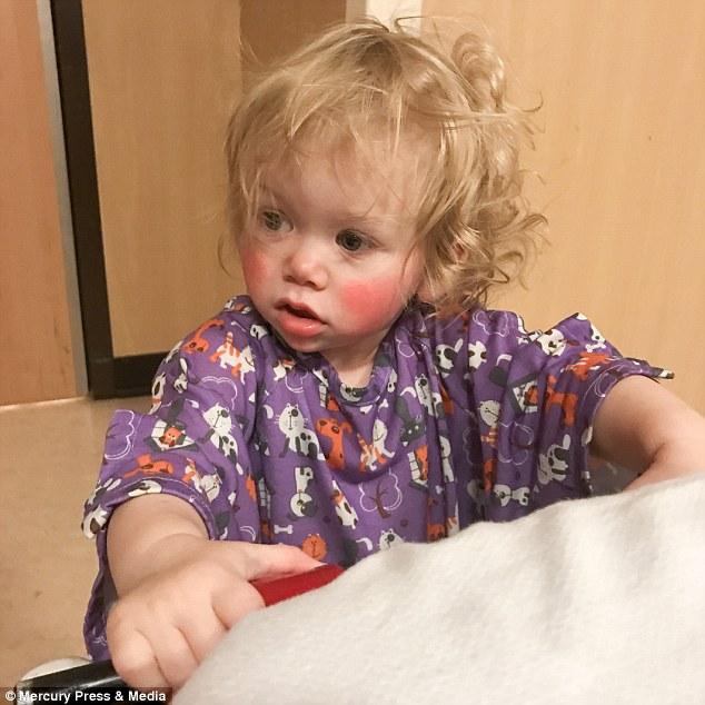 Αυτό το κοrιτsάκι που είναι 18 μηνώνείναι αλλεργικό στο νερό και βγάζει φουσκάλες κάθε φορά που κλαίει ή ιδρώνει