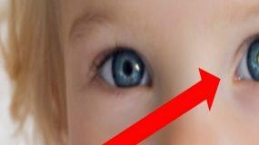 Παρατήρησαν τυχαία αυτό το σημάδι στο μάτι του παιδιού, αλλά αυτό που ανακάλυψαν τους συγκλόνισε