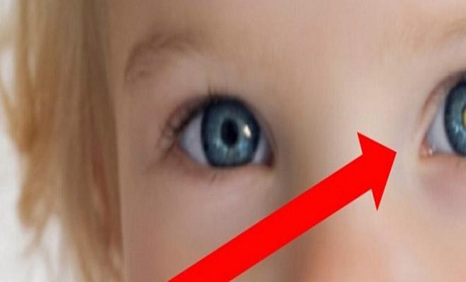 Παρατήρησαν τυχαία αυτό το σημάδι στο μάτι του παιδιού, αλλά αυτό που ανακάλυψαν τους συγκλόνισε
