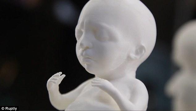 Πρωτοποριακή τεχνολογία επιτρέπει την 3D εκτύπωση μοντέλου ενός αγέννητου παιδιού 2 τρισδιαστατη απεικονιση μωρου1