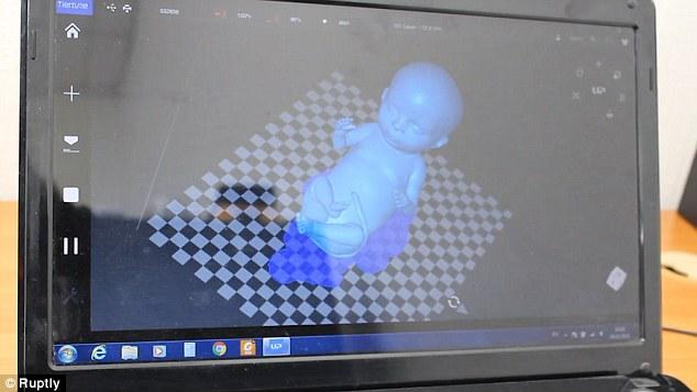 Πρωτοποριακή τεχνολογία επιτρέπει την 3D εκτύπωση μοντέλου ενός αγέννητου παιδιού 4 τρισδιαστατη απεικονιση μωρου3