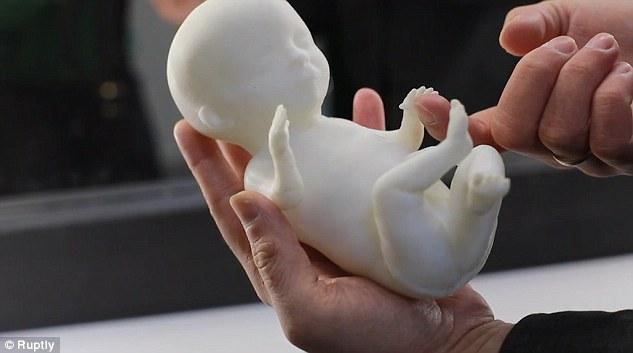 Πρωτοποριακή τεχνολογία επιτρέπει την 3D εκτύπωση μοντέλου ενός αγέννητου παιδιού 6 τρισδιαστατη απεικονιση μωρου5