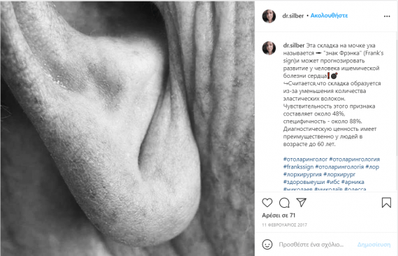 Εάν έχετε αυτό το σημάδι στο αυτί σας, μπορεί να κινδυνεύετε από εγκεφαλικό