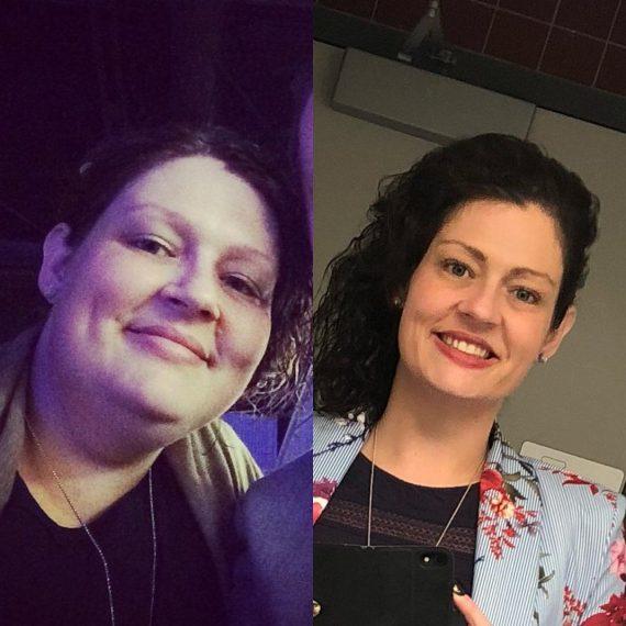 Αυτή η γυναίκα έκανε 3 απλά πράγματα που την συμβούλευσε ο διατροφολόγο της και κατάφερε και έχασε 68 κιλά