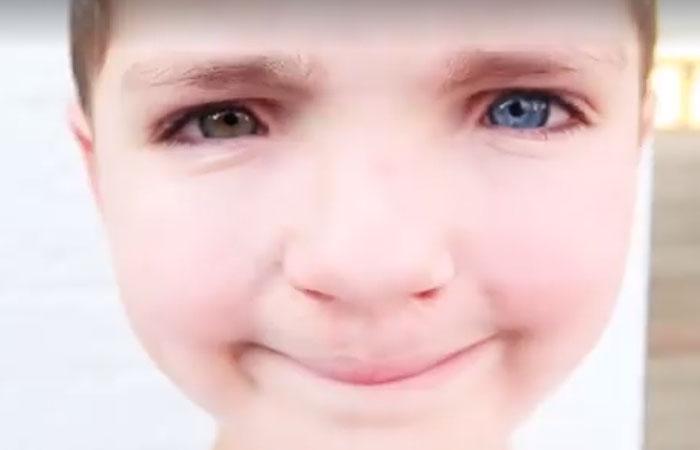 Αυτό το 7χρονο αγοράκι δεχόταν bullying για την εμφάνισή του μέχρι που βρήκε ένα γάτο ίδιο με αυτόν 6 7 χρονος δεχοταν bullying5