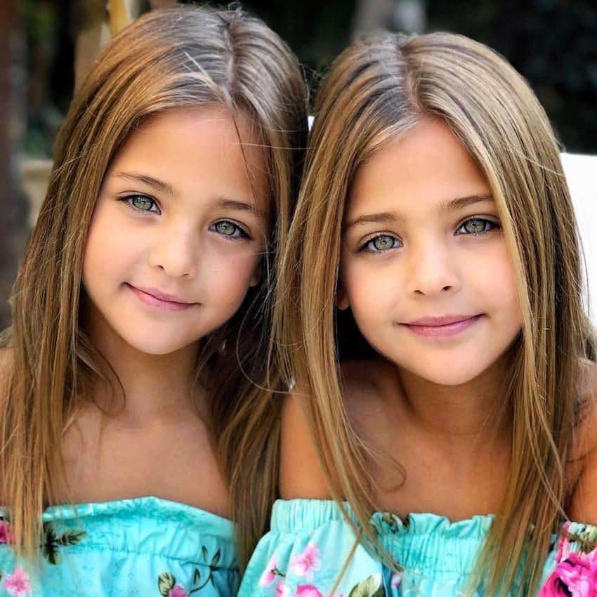 Αυτά τα δίδυμα κορίτσια γεννήθηκαν το 2010- Τώρα έχουν γίνουν διάσημα λόγω της ομορφιάς τους