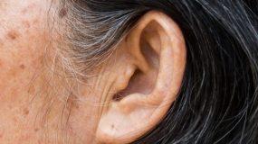 Εάν έχετε αυτό το σημάδι στο αυτί σας, μπορεί να κινδυνεύετε από εγκεφαλικό