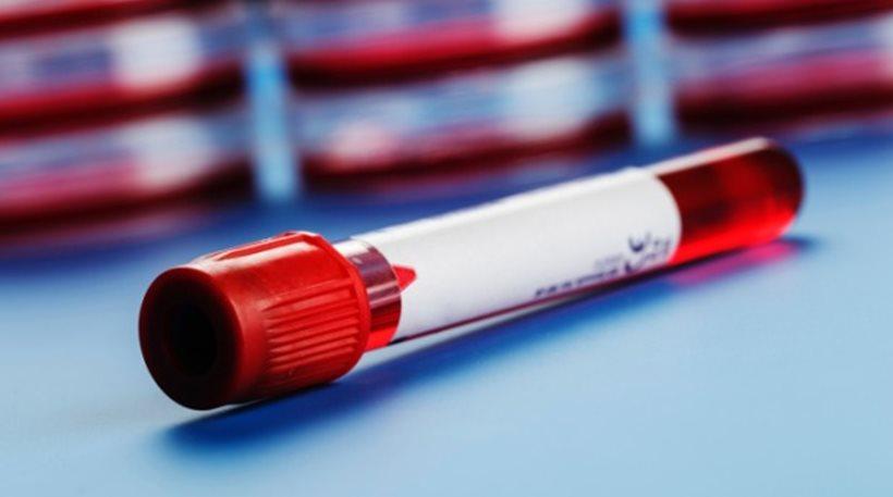 Έλληνας ογκολόγος έφτιαξε το πρώτο τεστ αίματος που ανιχνεύει ταυτόχρονα 8 είδη καρκίνου