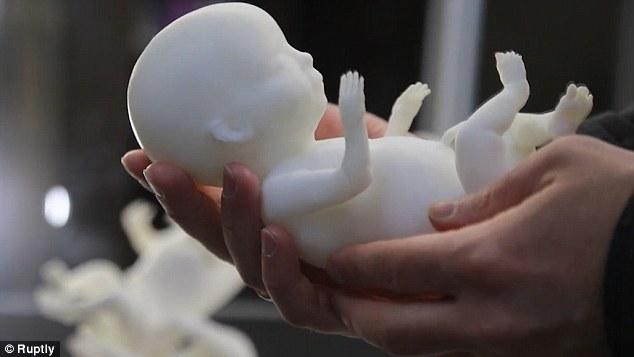 Πρωτοποριακή τεχνολογία επιτρέπει την 3D εκτύπωση μοντέλου ενός αγέννητου παιδιού