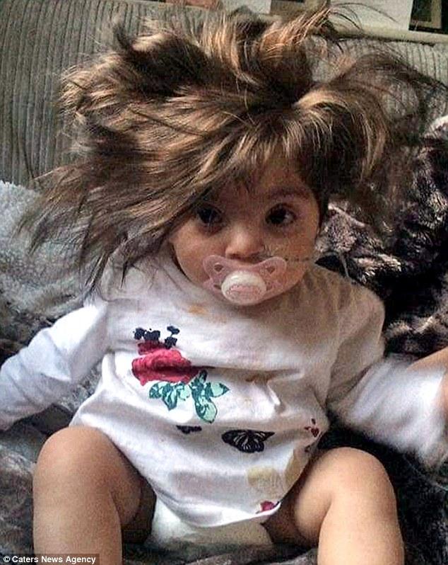 Αυτό το αξιολάτρευτο 8 μηνών κοpιτσάκι γεννήθηκε με τόσα πολλά μαλλιά που πολλοί νομίζουν ότι φοράει περούκα.