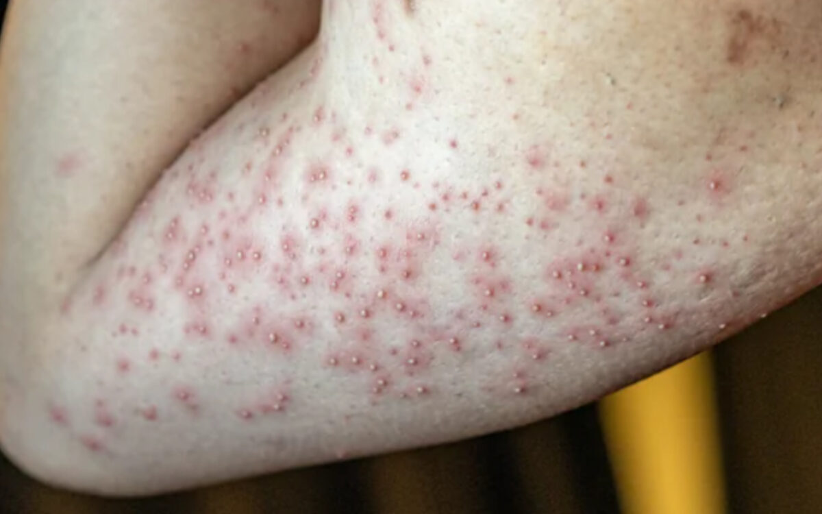 Αυτό είναι, σύμφωνα με τους ειδικους, το ένα ύφασμα που βλάπτει σοβαρά την υγεία σου!