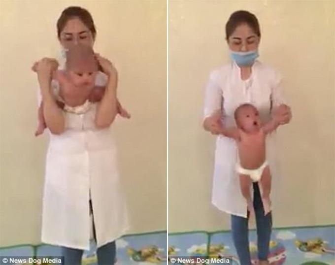 Σοκαριστικό: Γυναίκα περιστρέφει μωρό από τα χέρια και το κεφάλι του για να του κάνει μασάζ