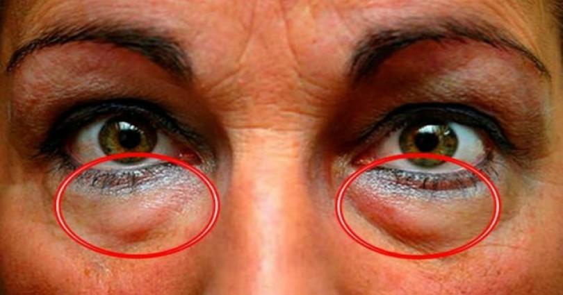 Αυτό είναι το ελληνικό μπαχαρικό που προστατεύει τα μάτια απο 90 παθήσεις!