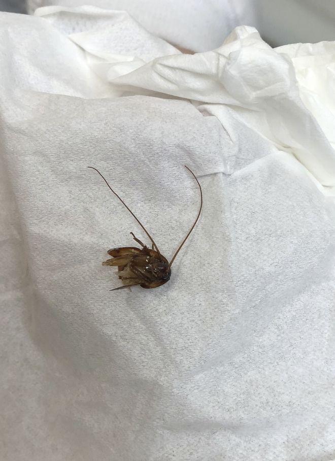 Ο απόλυτος εφιάλτης!!!Της μπήκε κατσαρίδα στο αυτί και την έβγαλαν μετά από 9 ημέρες (εικόνες)