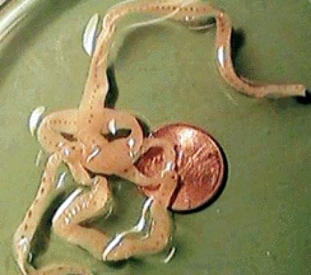 Μεγάλη Προσοχή! Κάτι που τρώμε όλοι, μπορεί να δημιουργήσει παράσιτα στον εγκέφαλο! 3 κατι που τρωμε ολοι1