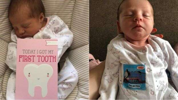 Απίστευτο! Βρέφος γεννήθηκε με δόντι – Σε ηλικία 12 ημερών έγινε ο νεότερος ασθενής σε οδοντίατρο [εικόνες]
