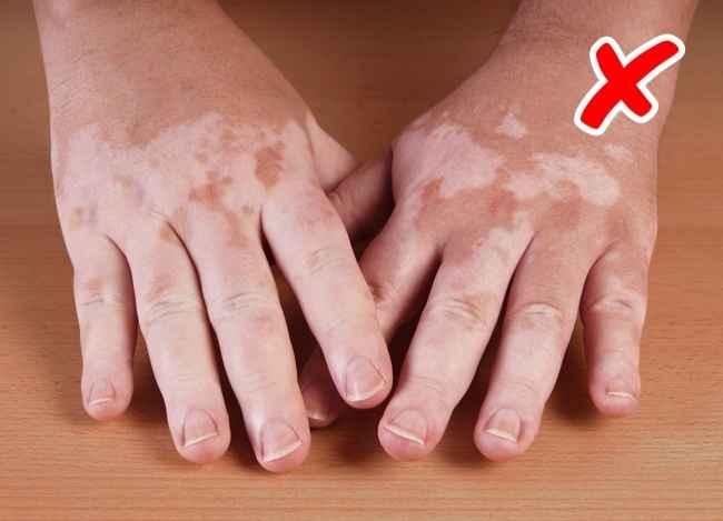7+1 σοβαρές ασθένειες που μας προειδοποιεί το δέρμα μας για αυτές