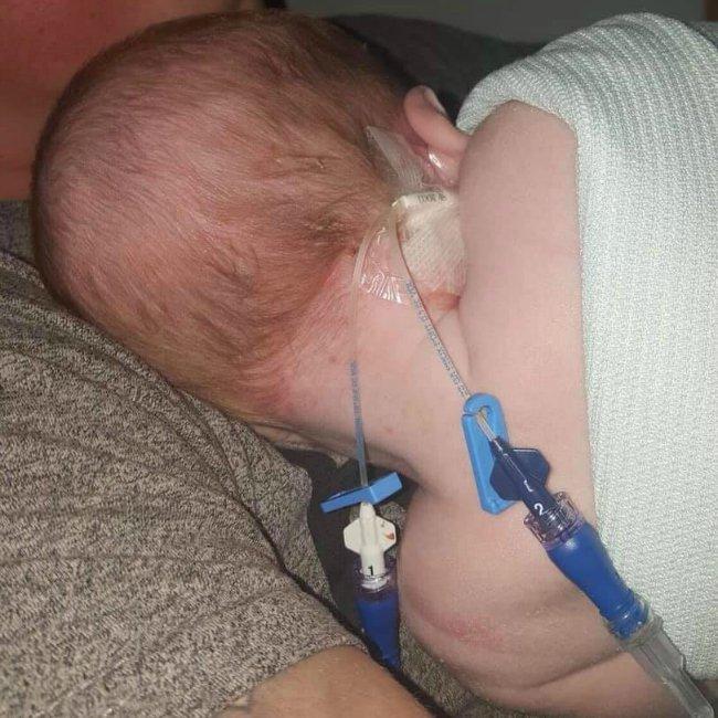 Νεογέννητο μωράκι κινδύνευσε να χάσει τη ζωή του από έρπητα