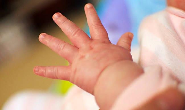 Μυστήριο με 18 γεννήσεις βρεφών χωρίς χέρια στην ίδια περιοχή