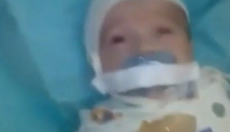 Βίντεο: Κόλησαν με μονωτική ταινία την πιπίλα σε στόμα μωρού 12 μόλις εβδομάδων…