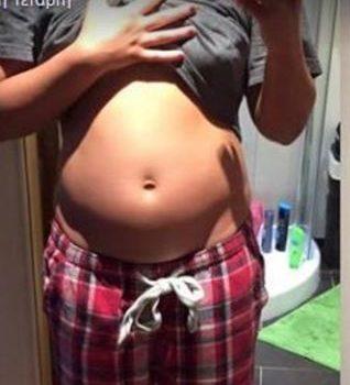 Απίστευτο! Γυναίκα φωτογράφισε το στομάχι της πριν και μετά τον ύπνο. Θα πάθετε πλάκα με την διαφορά!