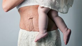 Ενα κείμενο αφιερωμένο στις γυναίκες που είδαν το σώμα τους να αλλάζει όταν γέννησαν