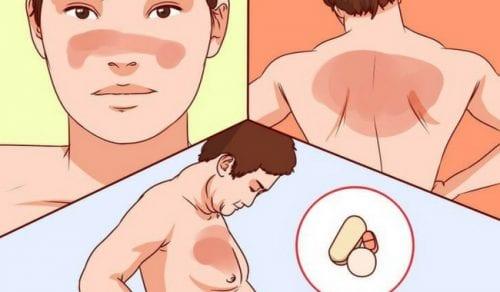 Τι πρέπει να γνωρίζετε για τον ερυθηματώδη λύκο!!!