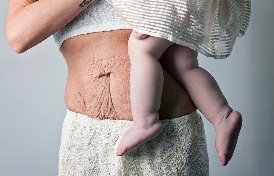 Το σώμα μίας μητέρας μετά την γέννα μέσα από συγκλονιστικές φωτογραφίες