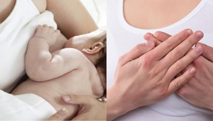 Πέτρωμα στο στήθος κατά τον θηλασμό: Γιατί συμβαίνει και πως να ανακουφιστείτε