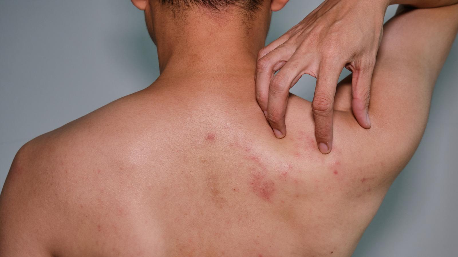 Αυτός είναι ο ιός που κινδυνεύει να νοσήσει το 95% των ατόμων άνω των 50