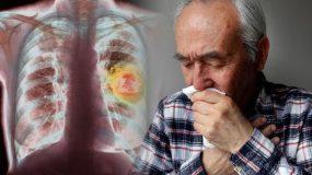 Καρκίνος του πνεύμονα:Αν δείτε αυτό στο φλέγμα σας Δείτε άμεσα το γιατρό σας!