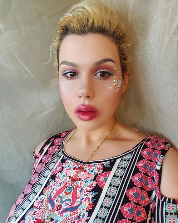 Η ιστορία της γυναίκας που ήταν 270 κιλά και έχασε 180 θα σας εμπνεύσει