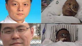 Απίστευτη ιστορία Κινέζων γιατρών με κορωνοϊό: Το δέρμα τους άλλαξε χρώμα μετά από νοσηλεία