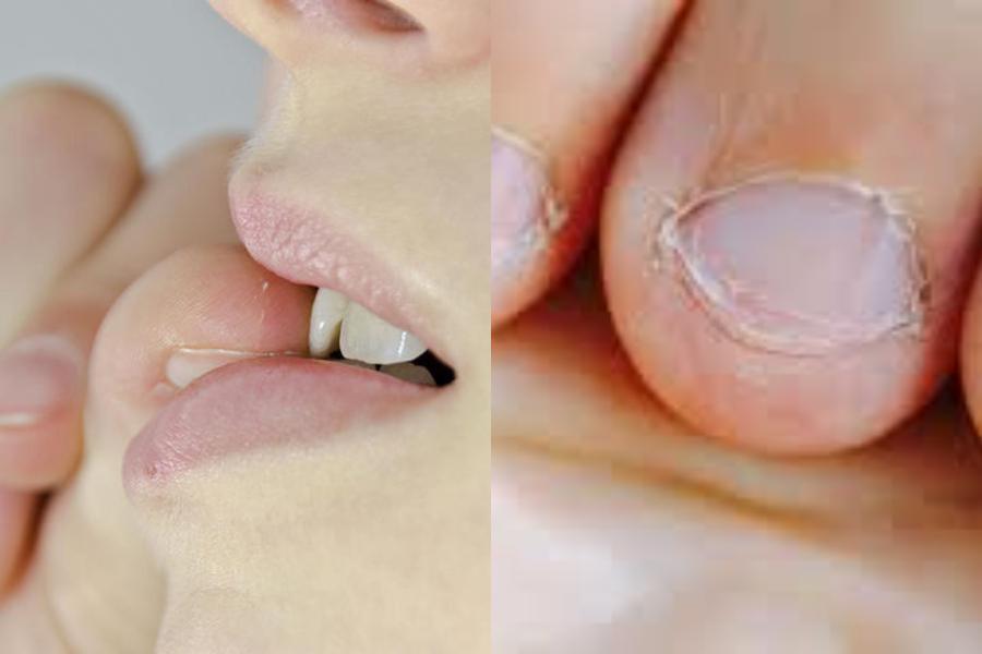 Τρώτε τα νύχια σας; Δείτε 10 τρόπους να κόψετε αυτή την κακή συνήθεια ΆΜΕΣΑ!