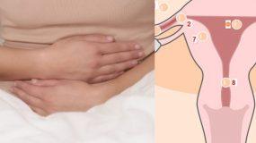 Έκτοπη κύηση: Τα ύπουλα συμπτώματα που παραπλανούν και οι κίνδυνοι στην εγκυμοσύνη!