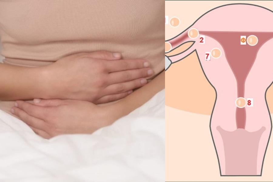 Έκτοπη κύηση: Τα ύπουλα συμπτώματα που παραπλανούν και οι κίνδυνοι στην εγκυμοσύνη!