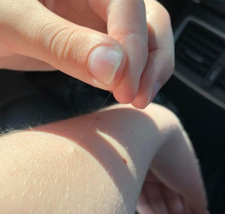 Ο λόγος που μερικές τρίχες του σώματός σας μπορούν να μεγαλώσουν υπερβολικά πολύ