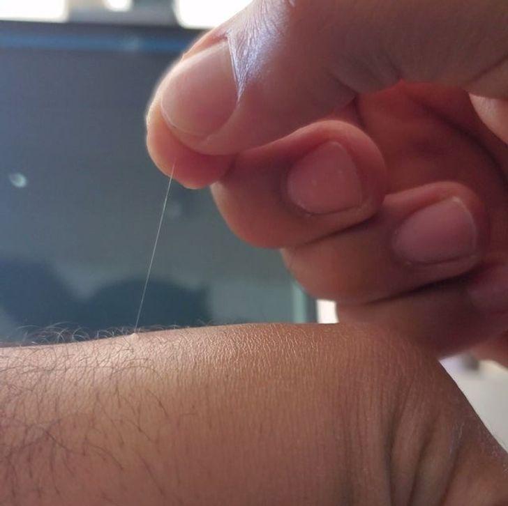 Ο λόγος που μερικές τρίχες του σώματός σας μπορούν να μεγαλώσουν υπερβολικά πολύ